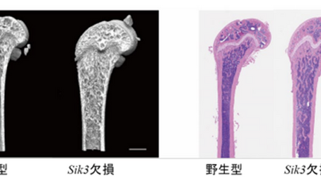 「破骨細胞のエネルギー代謝制御分子 SIK3 は、骨粗鬆症の新しい治療標的」-No.408