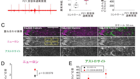 「脳の異常興奮を引き起こすグリア物質」-No.414
