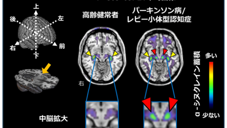 「生体脳で可視化することに世界で初めて成功」-No.374