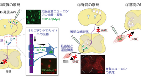 健康を科学で紐解く シリーズ174 「筋萎縮性側索硬化症(ALS)における異常なたんぱく質の広がり方を解明」