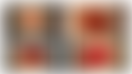 「世界初!腫瘍細胞増殖、老化(石灰化)のスイッチを発見」-No.373