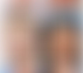 Identifican un gen causante del síndrome de Opitz C