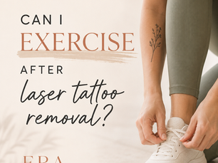 Can I Exercise After Laser Tattoo Removal?