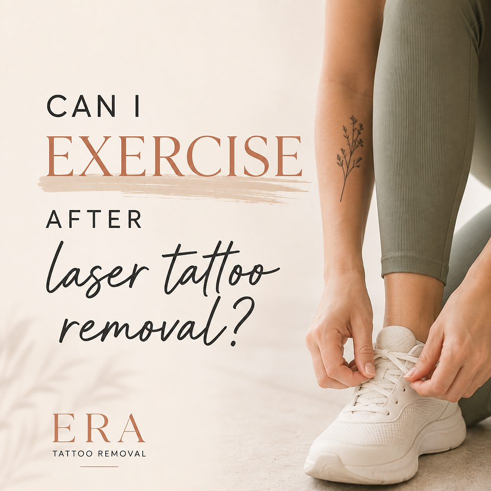 Can I Exercise After Laser Tattoo Removal?