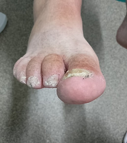 long nail 3_edited.jpg
