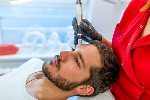 young white guy microneedling.jpg