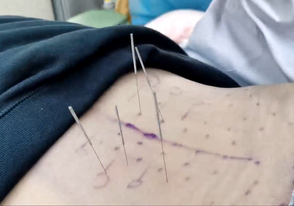 Thumbnail: 人体筋伤疾病的功能评估与治疗
