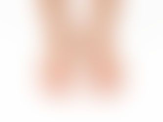 Pieds vus de face montrant une légère déviation des petits orteils vers l’intérieur sur fond clair.