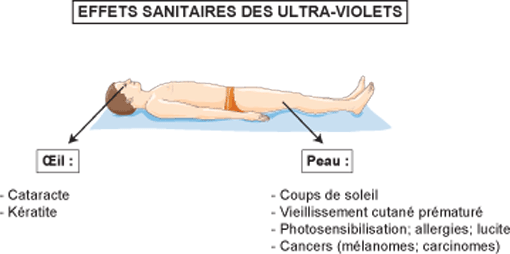 Effets sanitaires des UV