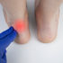 Achilles Tendinitis Treatment Birmingham and Warwickshire