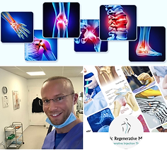 PRP treatment Birmingham