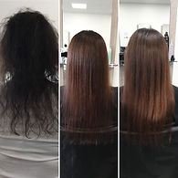 Prp hair treatment before and after