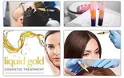 Hair loss clinic Birmingham UK