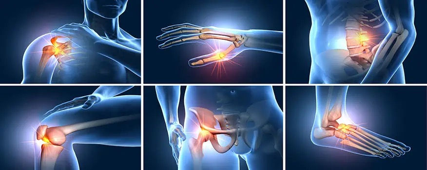 Expert Musculoskeletal Pain and Injury Treatment in Birmingham and Warwickshire