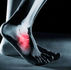Treatment for Ankle Arthritis Birmingham and Warwickshire