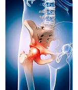 Hip pain treatment Birmingham