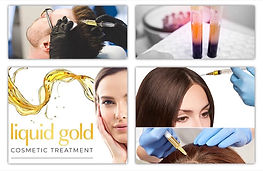 Hair loss treatment Birmingham