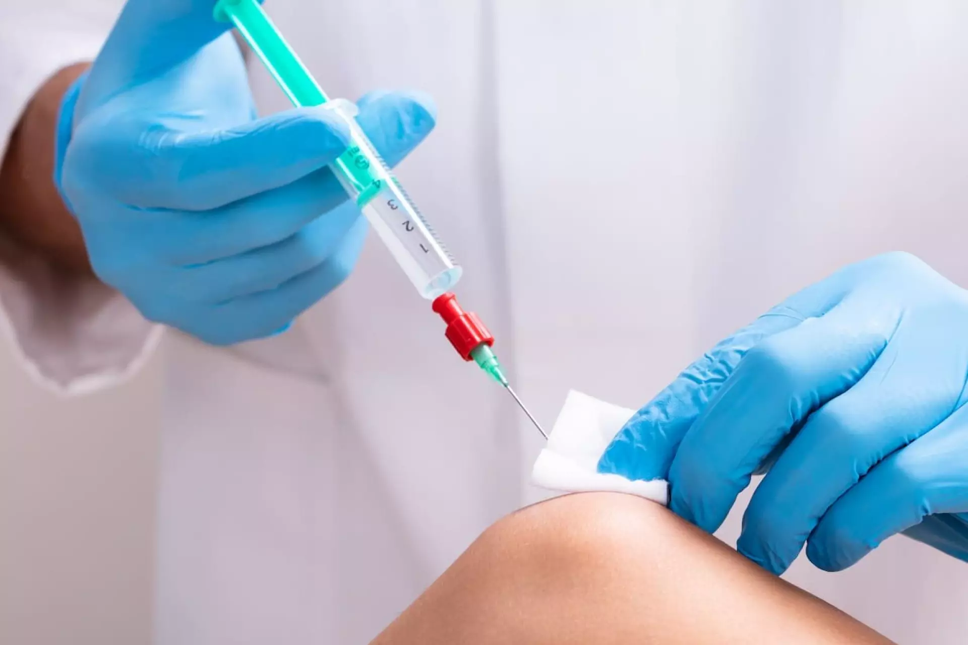 Knee osteoarthritis treatment with regular Hyaluronic Acid injection.