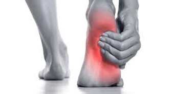 HEEL PAIN / PLANTAR FASCIITIS TREATMENT UK