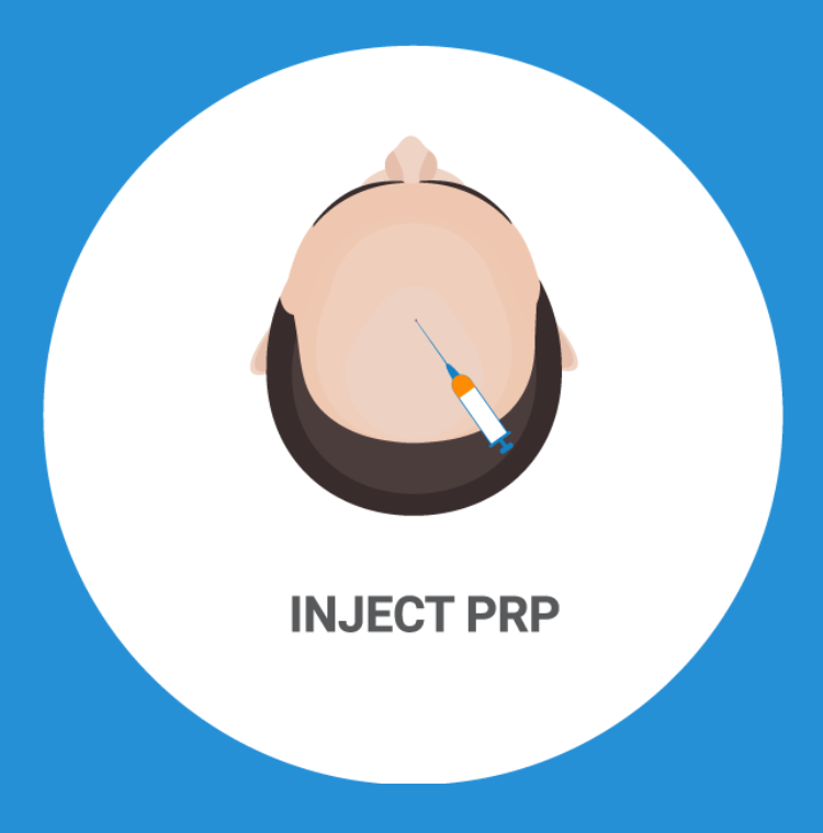 Platelet rich plasma (PRP) treatment for hair loss Birmingham / Solihull