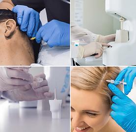 Stem cell hair loss treatment Birmingham