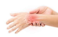 Wrist pain treatment Birmingham