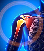 Shoulder pain treatment Birmingham