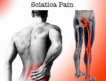 sciatica treatment