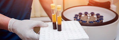 GOLFERS & TENNIS EBLOW INJECTION BIRMINGHAM