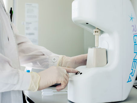 Regenera Activa Transplant vs FUE Hair Transplant for Hair Loss Treatment?