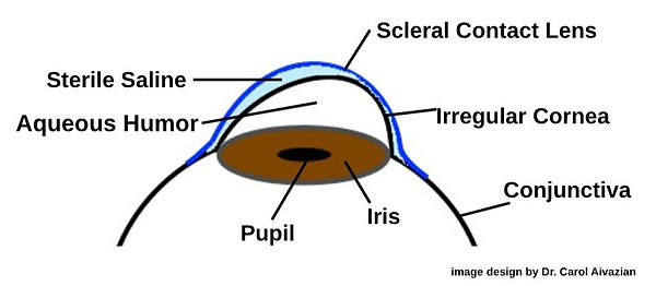 Vitreous Humor_edited.jpg