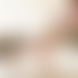 Exercises to Fix Pigeon Toes in Kids