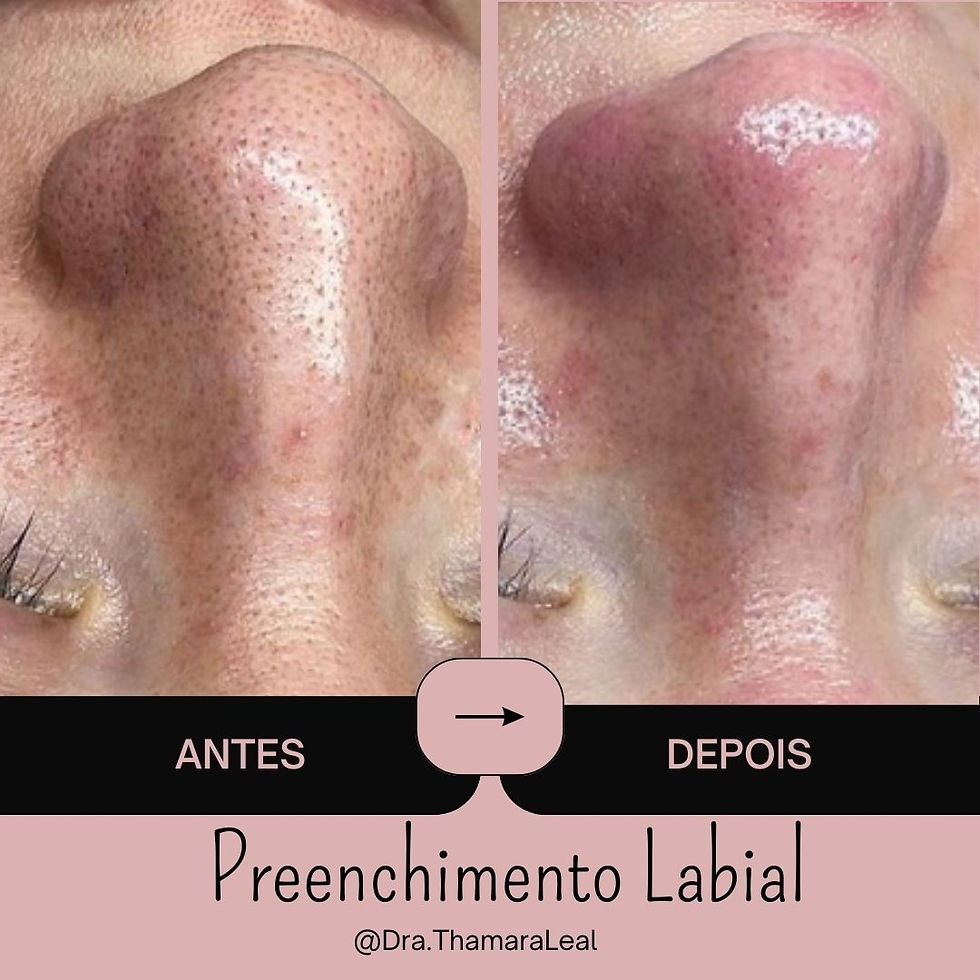 Facial