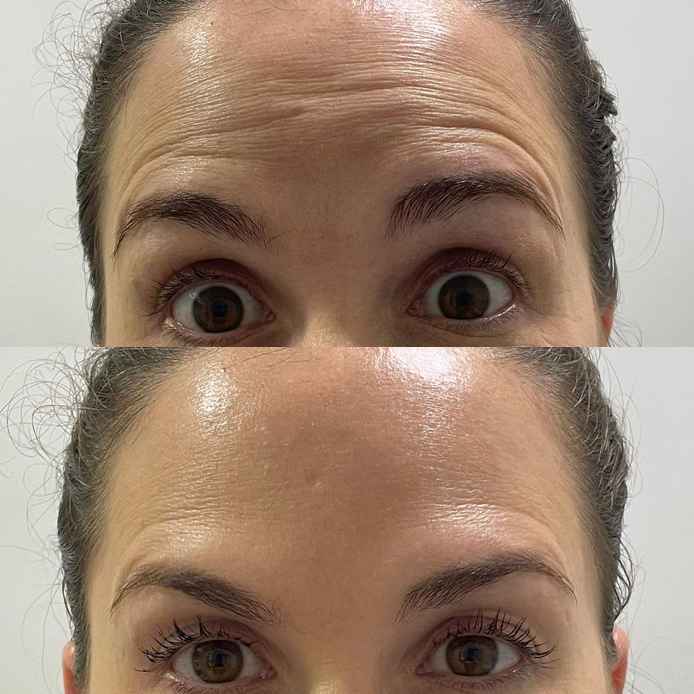 Facial