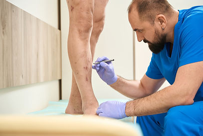 consulta-com-vascular-para-varizes.jpg
