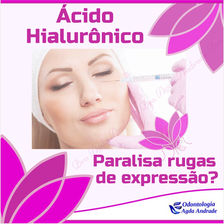 ÁCIDO HIALURÔNICO PARALISA RUGAS DE EXPRESSÃO?
