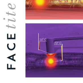 FaceTite治療のすべて：最先端の非侵襲的輪郭形成