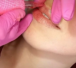 lips.jpg