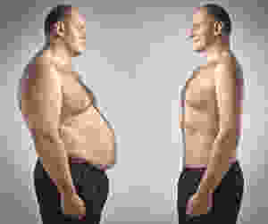 Síndrome Cardiometabólica
