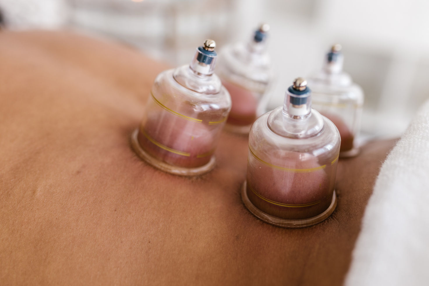 Cupping Crystal Lab
