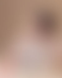 全球No1+護膚品牌 德國科研護膚專家NIVEA® 10多年精心科研成果 突破性專利淡斑煥白配方LUMINIOUS 630強勢誕生《雙效淡斑煥白系列 – NIVEA 最高效淡斑抗色素煥
