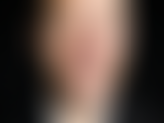 Fractional support/inquire today