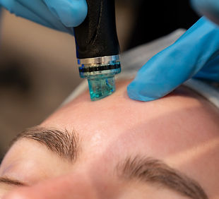 Hydrafacial with blurred foreground and background.jpg