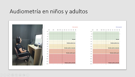 La audiometría mide la capacidad auditiva en niños y adultos
