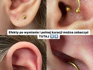 daith infekcja