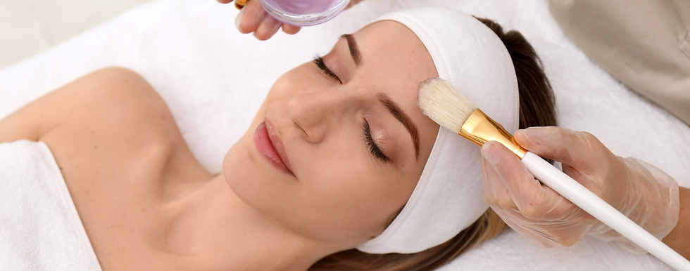 CMA Website Chem Peel.png