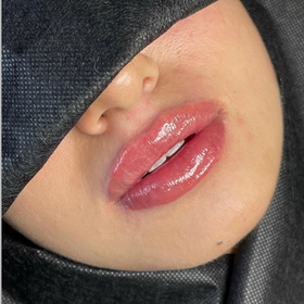 Lip Filler 