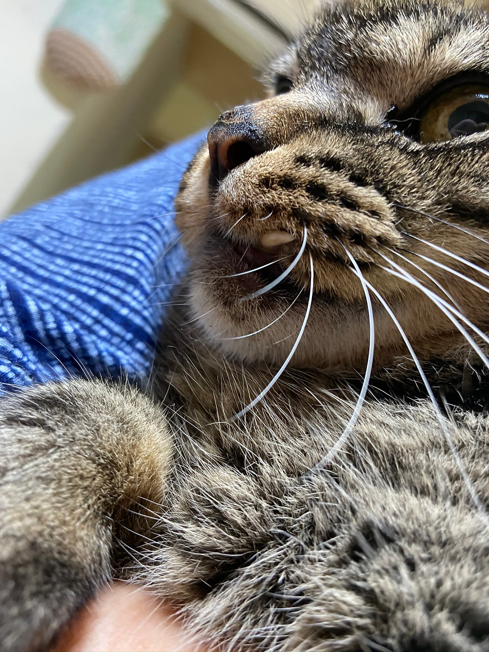 ちぃぷぅ 歯がとれそう