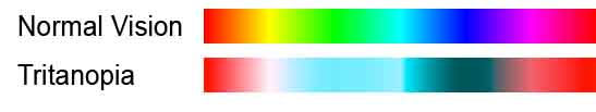 Different Types of Color Blindness 2021 | A Simple Explanation