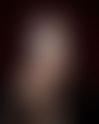 Symptoms Of Color Blindness (CVD), Latest Treatments & Solutions